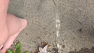 Peeing Through Catheter Outside