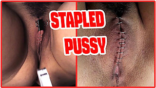 Sadistic Doctor Staples Teen Goth Girl's Hairy Pussy in Extreme BDSM Medical Punishment