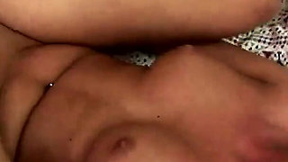 Unexpected Anal Scn2